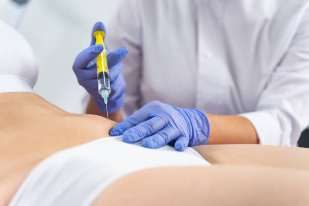 Fett Weg Spritze: Effektive Fettreduktion ohne chirurgischen Eingriff